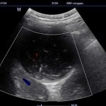 what can be seen on an ultrasound