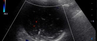 what can be seen on an ultrasound