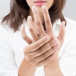 eczema on a woman&#39;s hands