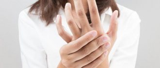 eczema on a woman&#39;s hands
