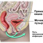Image 1: Cystitis - Family Doctor Clinic