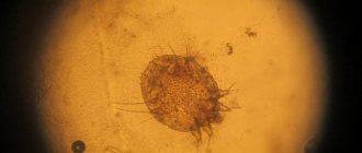 what does a scabies mite look like?