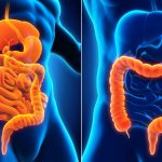 Intestinal infection: how to treat