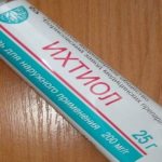 What does ichthyol ointment help with?