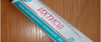 What does ichthyol ointment help with?