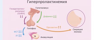 Симптомы пролактиномы у женщин - Изображение №1