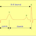 Correlation of ECG intervals with the phases of the cardiac cycle (ventricular systole and diastole).