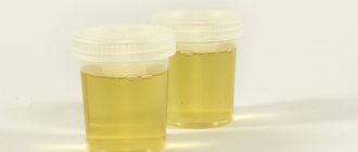 Urine for testing is poured into disposable containers