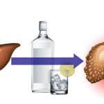 At first, alcohol intoxication is still reversible, and when the abuse stops, liver function will gradually recover almost completely. But if people continue to abuse alcohol, then irreversible changes occur in the organ. 